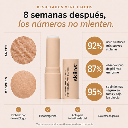 Skiins™ | Stick de Silicona para Marcas de Acné