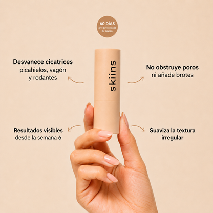 Skiins™ | Stick de Silicona para Marcas de Acné