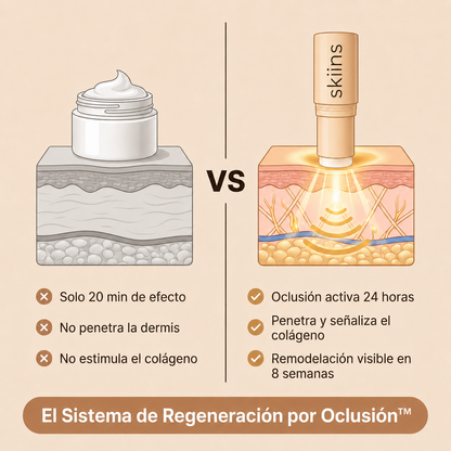 Skiins™ | Stick de Silicona para Marcas de Acné